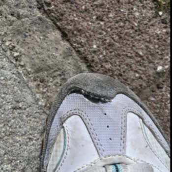 Skechers Ayakkabılarda Kısa Sürede Açılma Ve Deformasyon Sorunu
