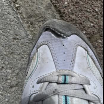 Skechers Ayakkabılarda Kısa Sürede Açılma Ve Deformasyon Sorunu