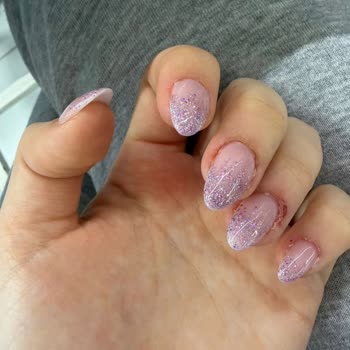 Aura Nail Art Tırnaklarım Hem Yara Oldu Hem de Tırnaklarımda Küflenme Oluştu