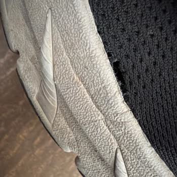 Skechers Ayakkabısının Kalitesizliği Ve Satış Sonrası İhmali