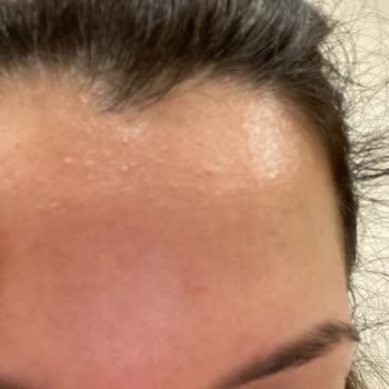 Yves Rocher Sebo Active Clear Yüz Kremi Cildimde Şiddetli Yağlanma Ve Sivilcelere Yol Açtı
