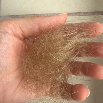 Yeni Canlandırıcı Şampuan Saç Dökülmesine Neden Oldu
