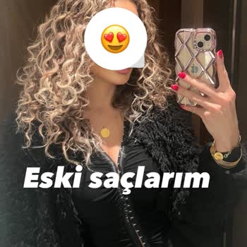 Mavi Açıcı Uygulaması Sonrası Saç Kırılması Ve Çözüm Yokluğu