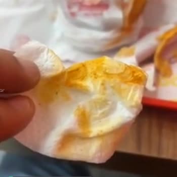Doysos Hatay Döner Ustanın Kafasında Saç Kılı Koruma Bonesi Yok