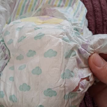 Bebek Bezlerinde Delik Ve Yırtıklar Cilt Tahrişi Ve Sızdırma Yarattı