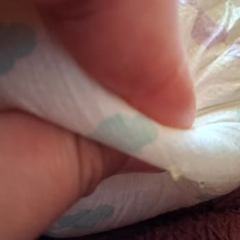 Bebek Bezlerinde Delik Ve Yırtıklar Cilt Tahrişi Ve Sızdırma Yarattı