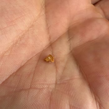 Tadelle Çikolatasındaki Yabancı Cisim Dişime Zarar Verdi