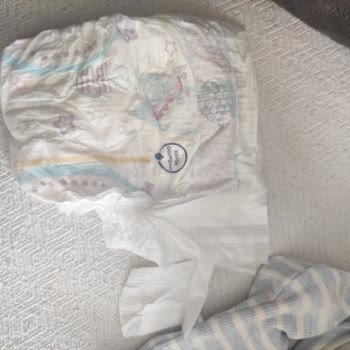 Molfix Bebek Bezinde Cırtı Kopması Kullanılamaz Hale Getiriyor