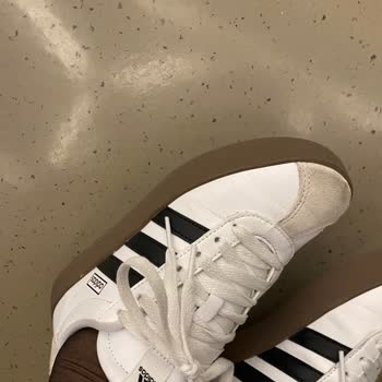 Adidas Ayakkabısının Kısa Sürede Deforme Olması Ve İade Talebi