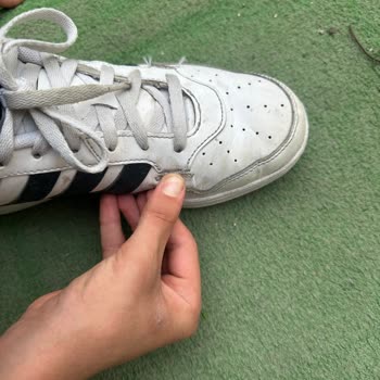 Adidas Ayakkabım Kısa Sürede Yırtıldı, Firma Kullanıcı Hatası İddiası