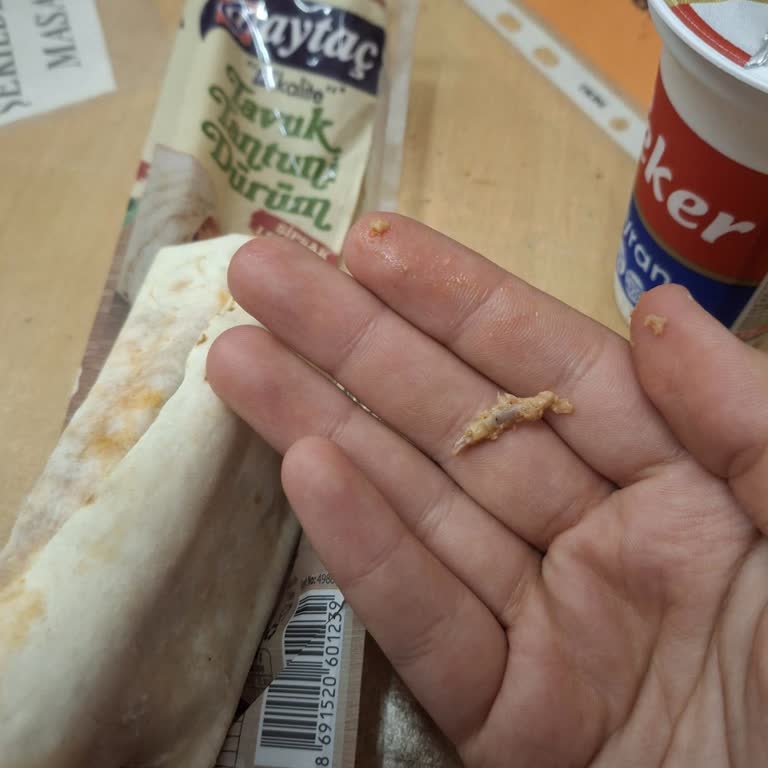 Aytaç Markalı Tavuk Tantunide Kemik Parçası Bulunması
