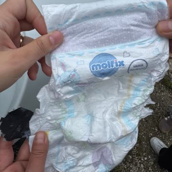 Molfix Bebek Bezinde Yabancı Parça Bulunması Ve İade Talebi