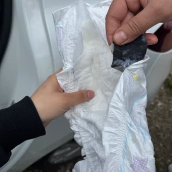 Molfix Bebek Bezinde Yabancı Parça Bulunması Ve İade Talebi