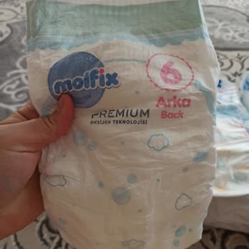 Molfix Premium Bebek Bezinde Sert Doku Ve Sızdırma Problemi
