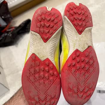 Adidas Ürünlerinde Hızlı Yıpranma Ve Çocuk Kullanıcı Hatası İddiası