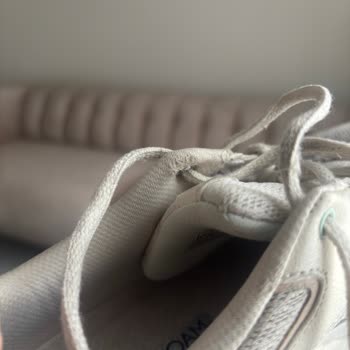 Skechers D’Lites Ayakkabımda Erken Deformasyon Ve Kullanıcı Hatası Reddi