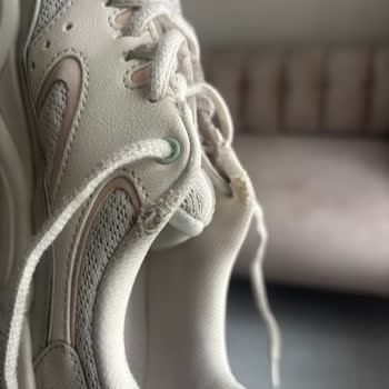 Skechers D’Lites Ayakkabımda Erken Deformasyon Ve Kullanıcı Hatası Reddi