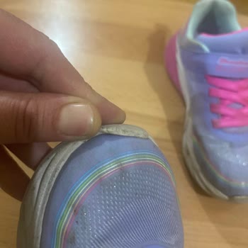Skechers Çocuk Ayakkabısında Kısa Sürede Açılma Sorunu