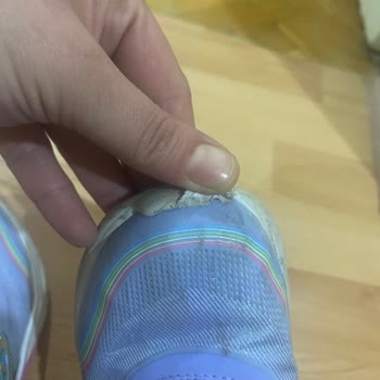 Skechers Çocuk Ayakkabısında Kısa Sürede Açılma Sorunu