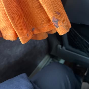 Bakımsız Otobüs Ve Bagaj Sorunu Nedeniyle Ücret İadesi Talebi
