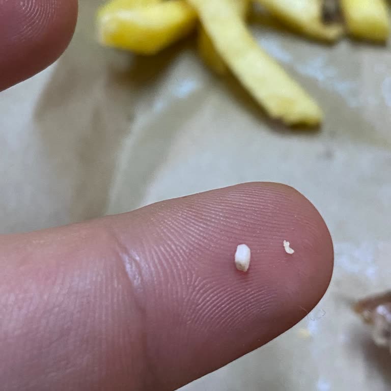 Burger King Esenler Şubesinde Köfte Burgerde Kemik Parçası Keşfedildi