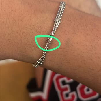 Suya Dayanıklı Olduğu Söylenen Bileklik Kısa Sürede Yeşillenerek Garanti İhlali