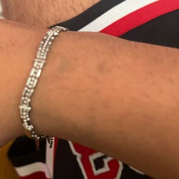 Suya Dayanıklı Olduğu Söylenen Bileklik Kısa Sürede Yeşillenerek Garanti İhlali