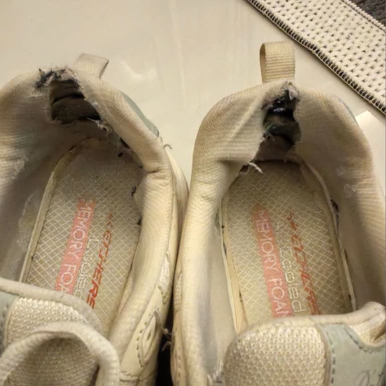 Skechers Ayakkabılarda Hızlı Yırtılma Ve Garanti Reddi Hayal Kırıklığı