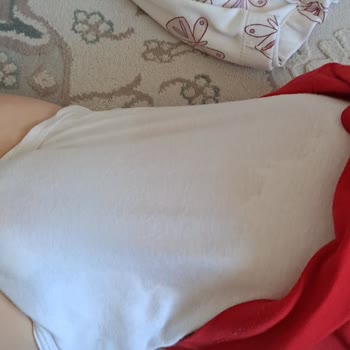 Molfix Fit Bebek Bezinde Çiş Sızıntısı Ve Şiddetli Pişik Şikayeti