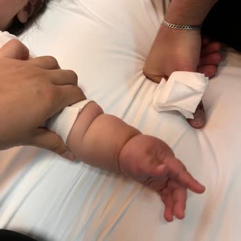 Yanlış Açılan Damar Yolu Yeni Doğan Bebeğin Kolunda Şişlik Ve Morarma Oluşturdu