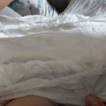 Molfix Bebek Bezinde Çift Taraflı Yırtık: Güvenlik Ve Maddi Mağduriyet
