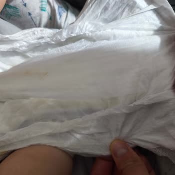 Molfix Bebek Bezinde Çift Taraflı Yırtık: Güvenlik Ve Maddi Mağduriyet