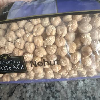 Nohut Paketinde Kurtçuk Bulunması Ve Hijyen Şikayeti