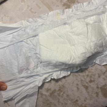 Molfix Bebek Bezinde Emici Ped Kaplamama Hatası