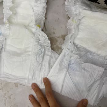 Molfix Bebek Bezinde Emici Ped Kaplamama Hatası