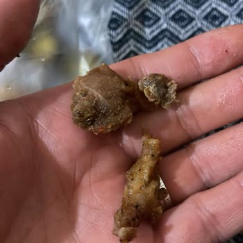 Alanya Belediyesi Sağlık Riski Oluşturan Hijyen İhlali