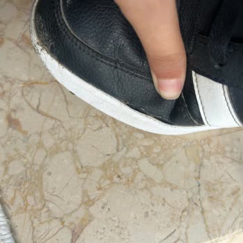 FLO Ayakkabı Adidas Ayakkabısının Kısa Sürede Açılması Ve Mağazanın İade Ve Değişim Reddi