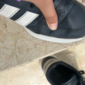 FLO Ayakkabı Adidas Ayakkabısının Kısa Sürede Açılması Ve Mağazanın İade Ve Değişim Reddi