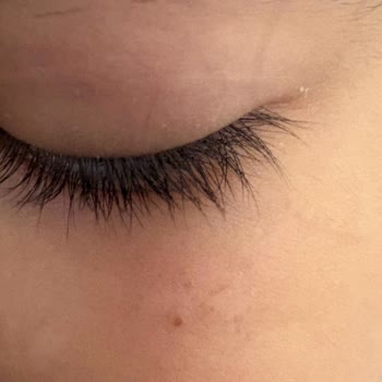 Garnier Çocuk Güneş Kremi Yetersiz Koruma Sağladı Ve Cilt Lekelerine Neden Oldu