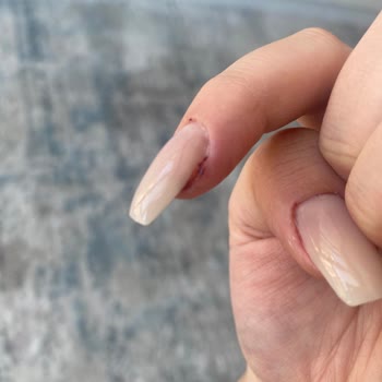 Bloom Beauty Studio Deneyimsiz Kadro Ve Hijyen Sorunu Nedeniyle Ciddi Kesikler Ve Yanık