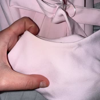 Lekeli Elbise İçin İade Talebim Reddedildi Ve Destek Yanıt Vermiyor