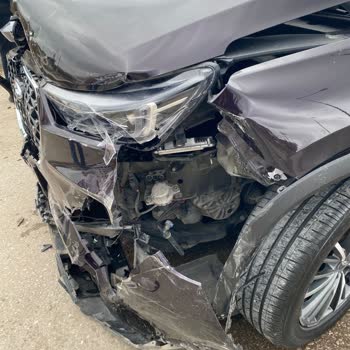Airbag Açılmadı, Kaza Sonrası Hayati Güvenlik Sorunu