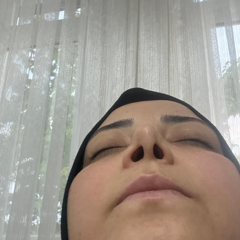 Op. Dr. Onurkan İdacı Burun Ameliyatında Etlerin Kökünden Kazınması Ve Haksız Muamele