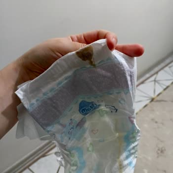 Molfix Bebek Bezinde Yabancı Madde, Hijyen Endişesi Ve İade Talebi