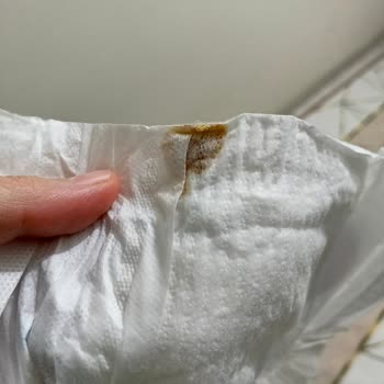 Molfix Bebek Bezinde Yabancı Madde, Hijyen Endişesi Ve İade Talebi