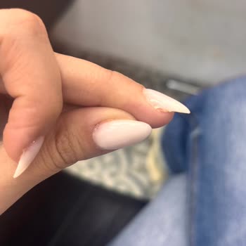 Protez Tırnak İşleminde Özensiz Uygulama, Tam İade Talebi