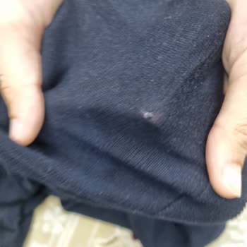 Kısa Sürede Yırtılan Skechers Ayakkabı İçin Değişim Ve İade Talebi