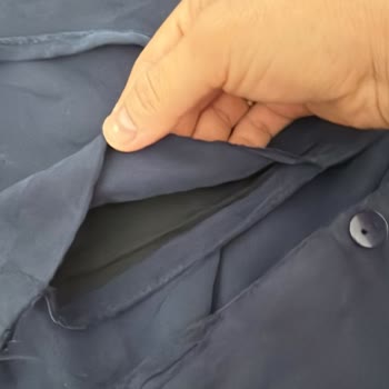 Yıkama Sonrası Açılan Dikişler Ve Geri Ödeme Gecikmesi