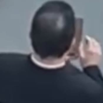 Estecenter Saç Ekimi Başarısızlığı Ve Yetersiz Tazminat Talebi