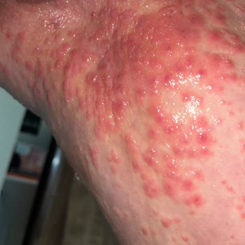 Medicana Sağlık Grubu Yanlış Teşhis, Etkisiz Tedavi ve Empati Eksikliği